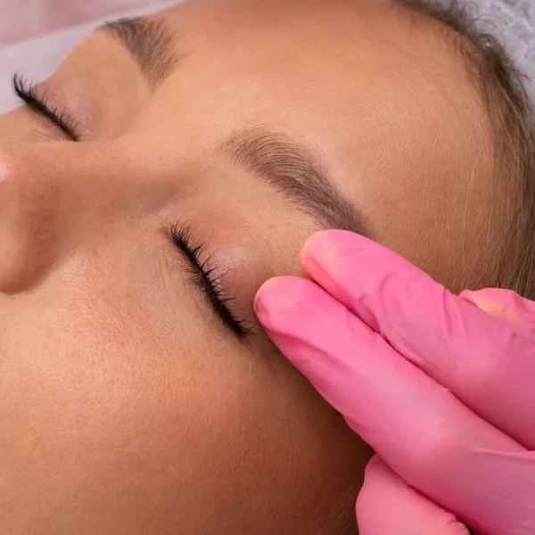 PRX-T33 terapia – neinvazívna revitalizácia a lifting pleti